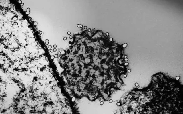 尼帕病毒是什么?